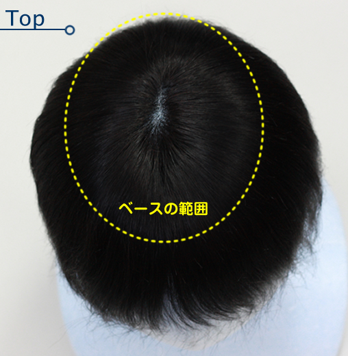 top